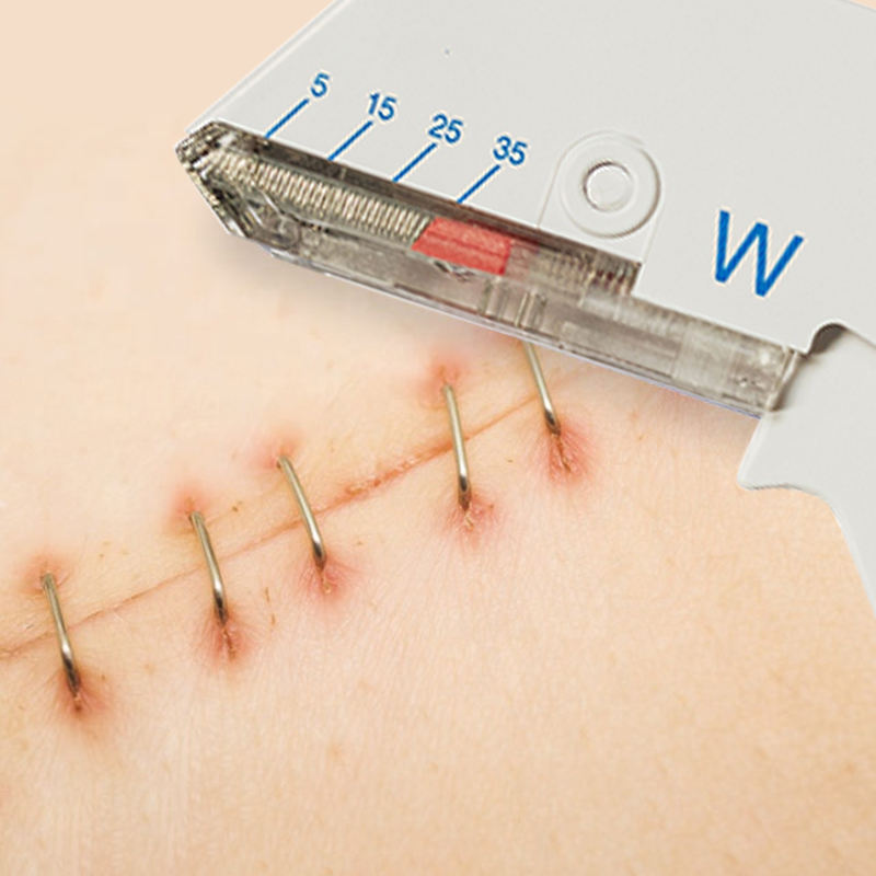 Disposable Skin Stapler for Skin Suture